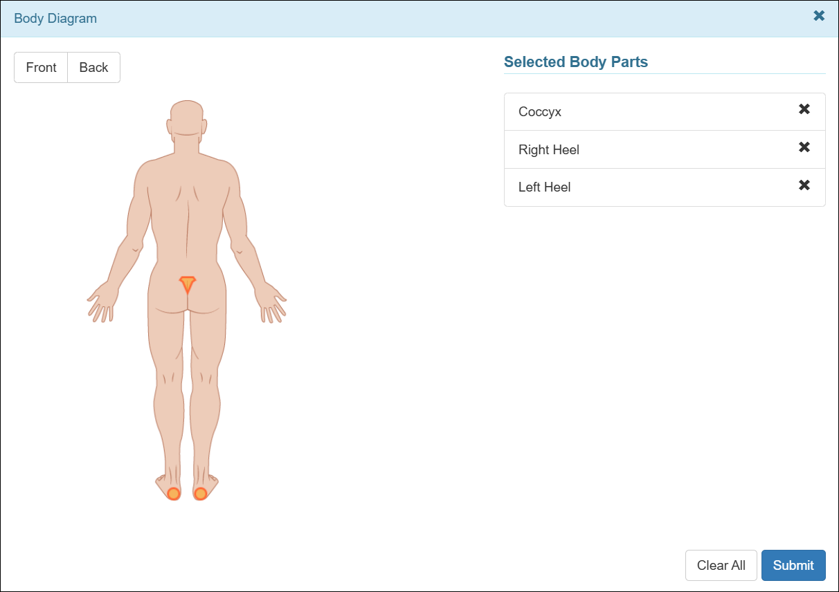 Screenshot showing the new body parts added in the Body Diagram.