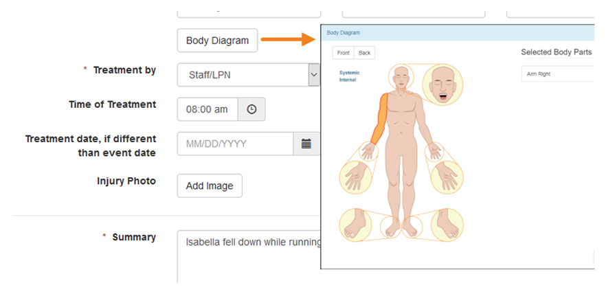 A screenshot highlighting the body diagram in Therap GER application