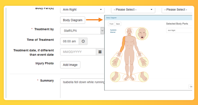 A screenshot highlighting the body diagram in Therap GER application